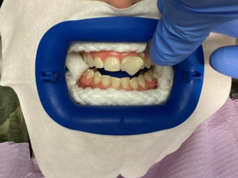 Before Image