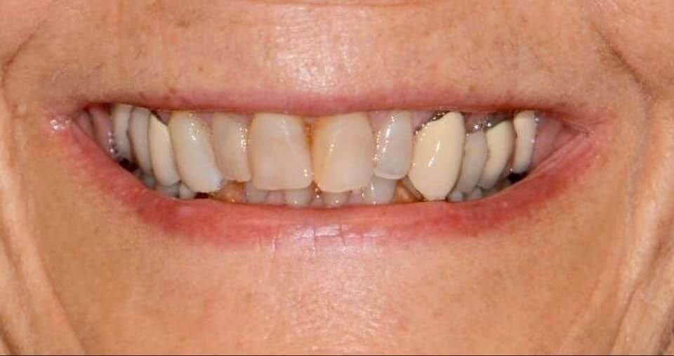 Before Image