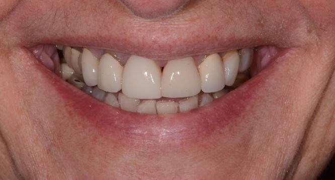 Before Image