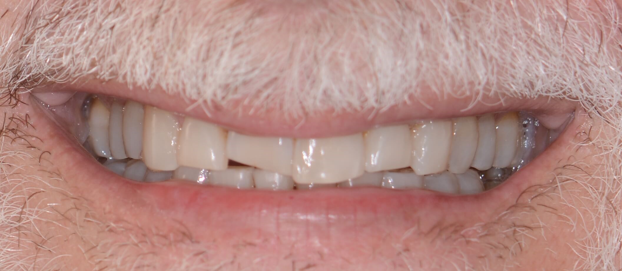Before Image