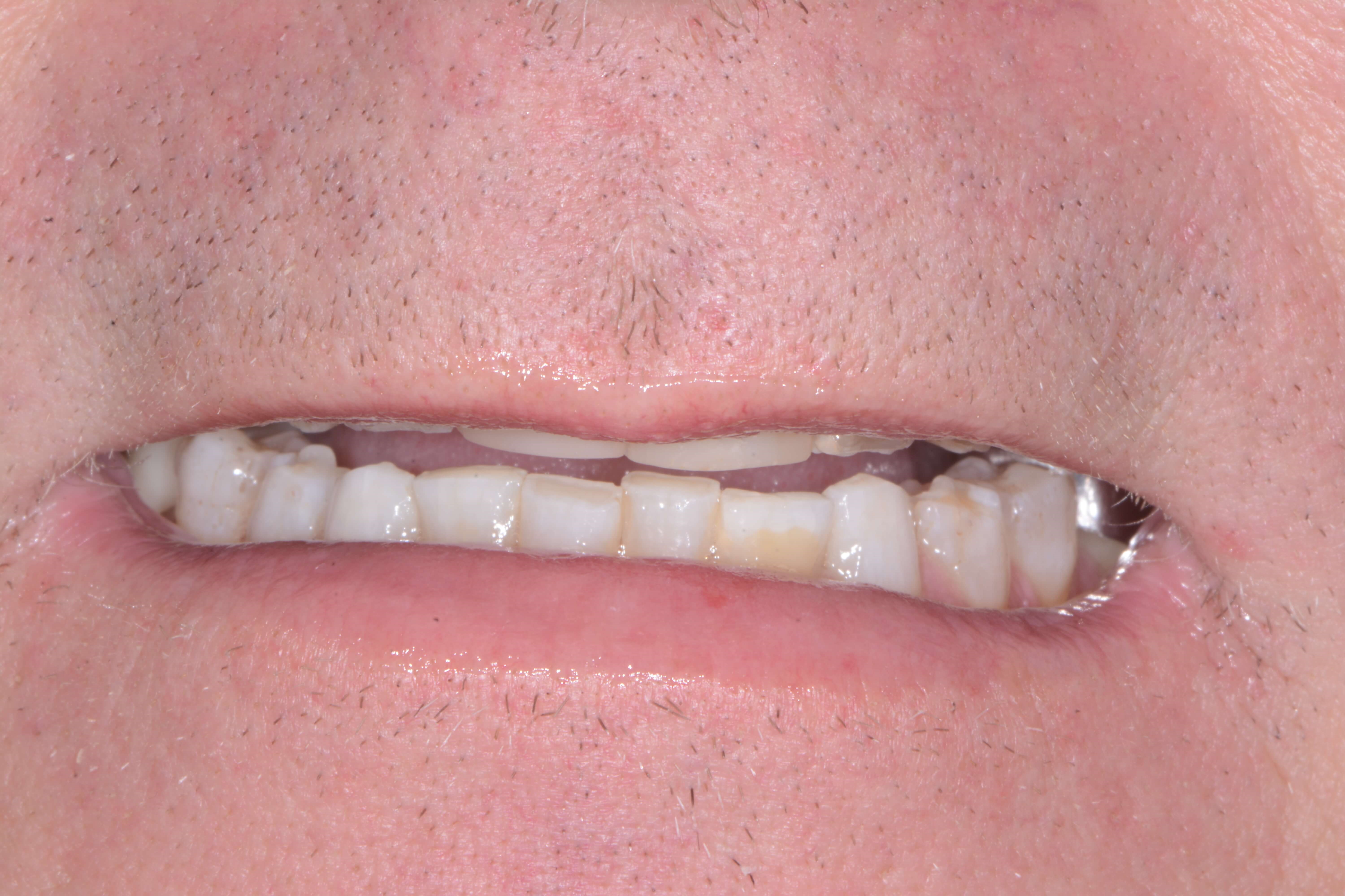 Before Image