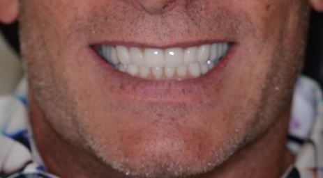 After Image