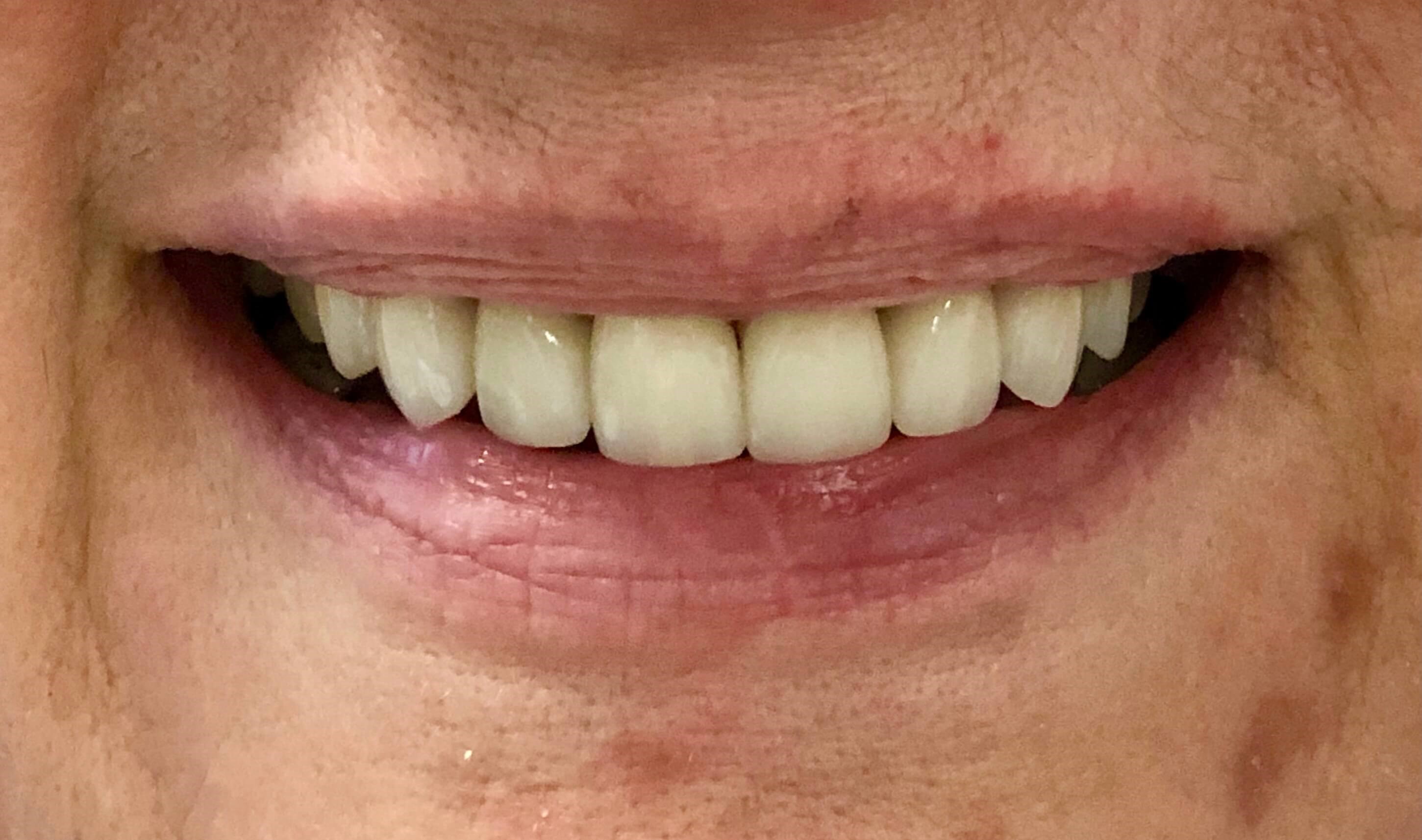 After Image