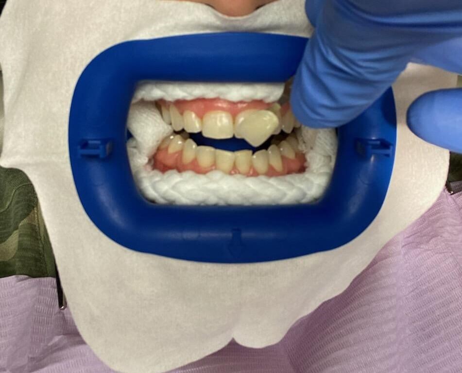 Before Image
