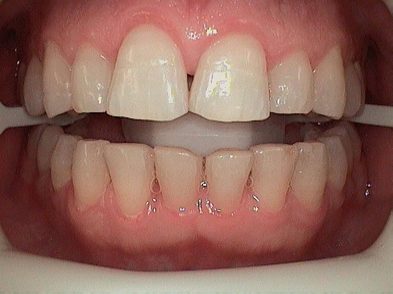 Before Image