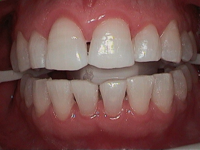 After Image