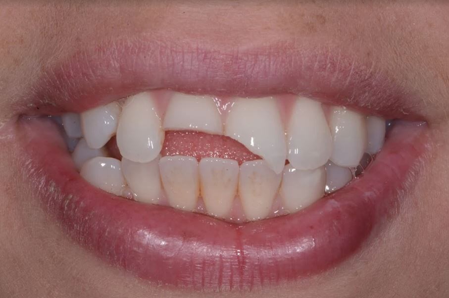 Before Image