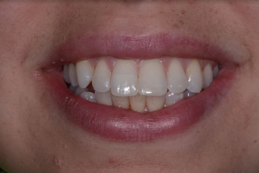 After Image