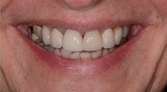 Before Image
