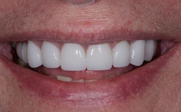After Image