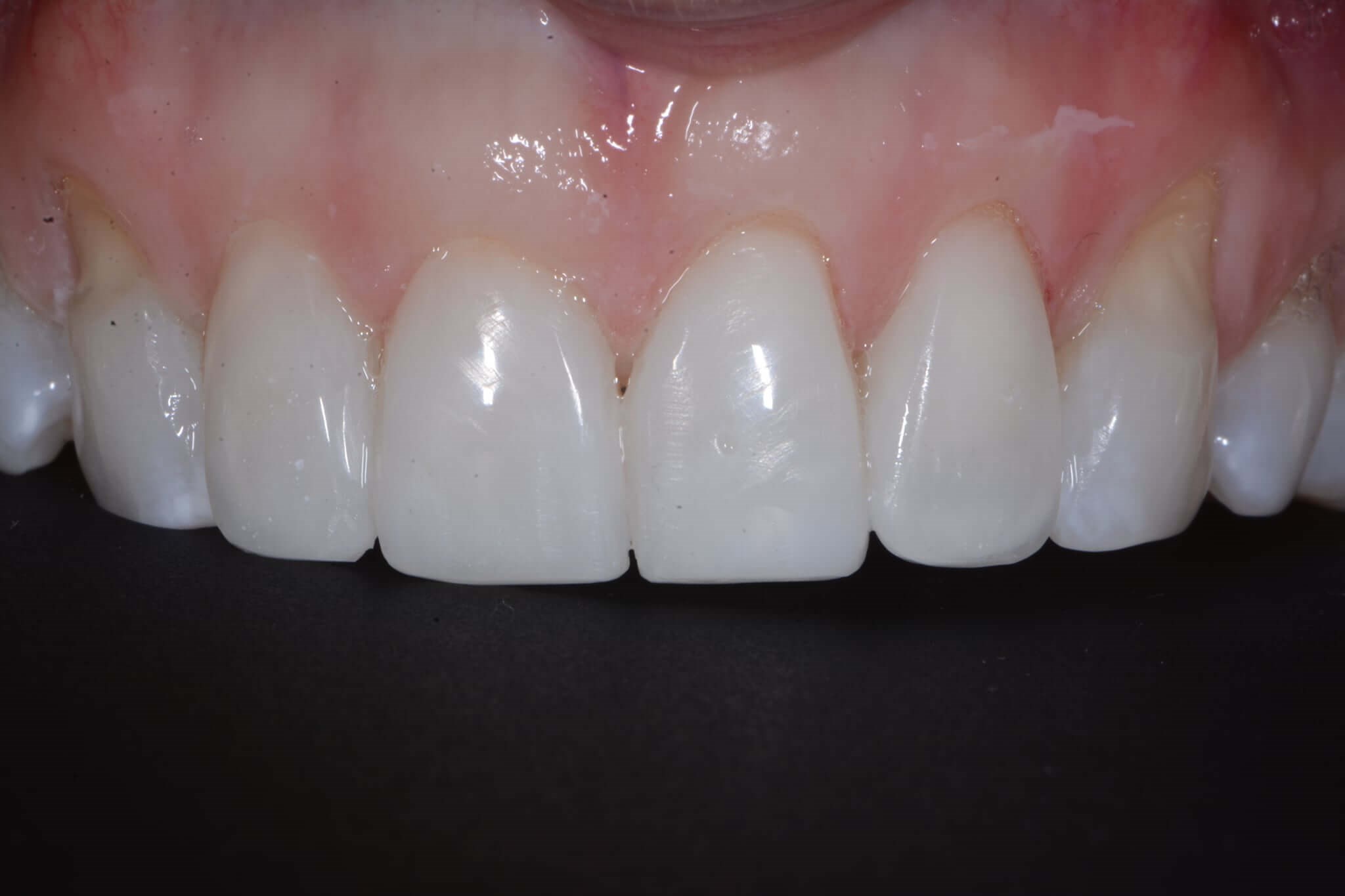 After Image