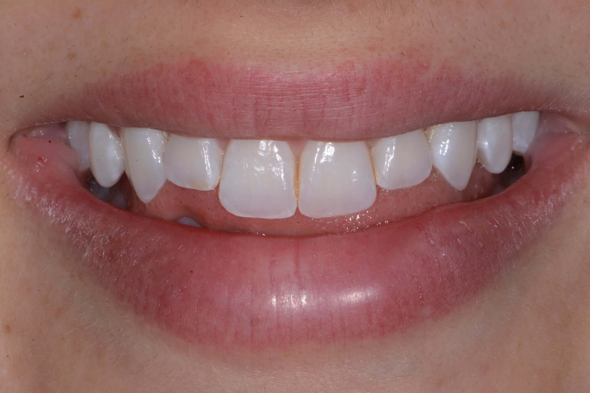 Before Image