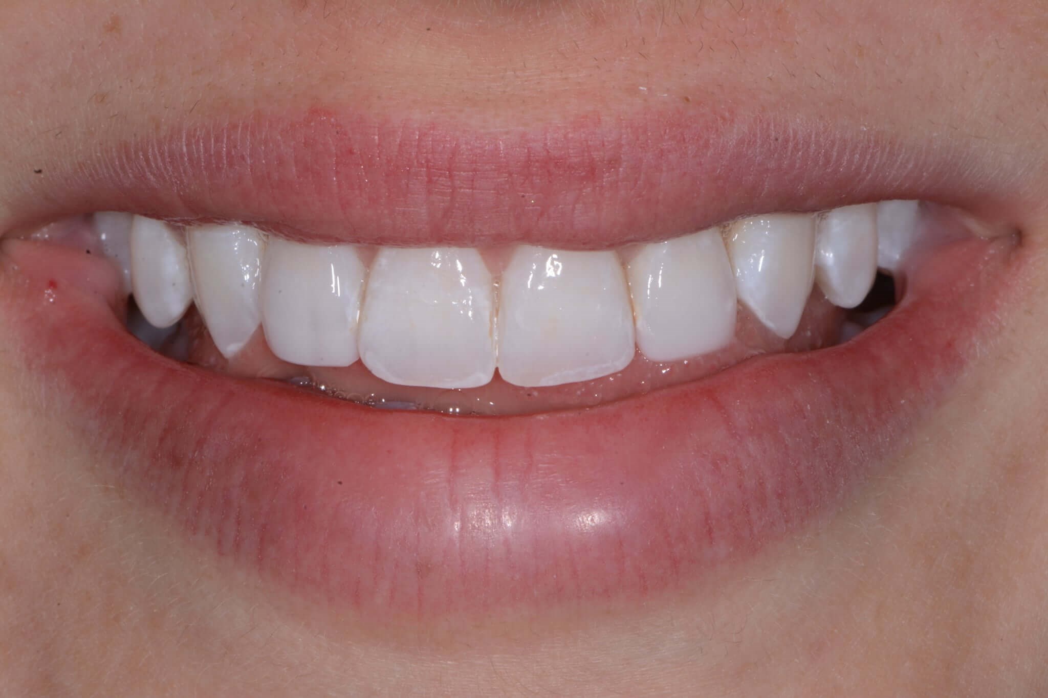 After Image