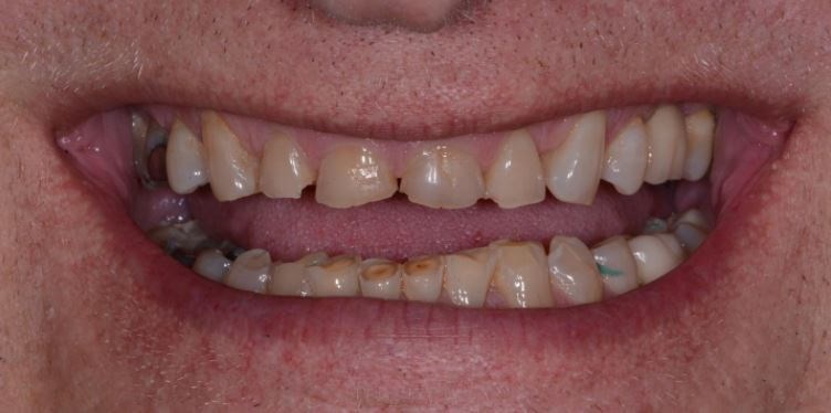 Before Image