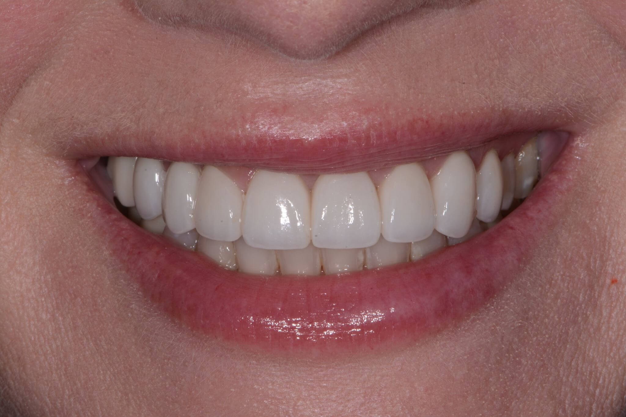 After Image