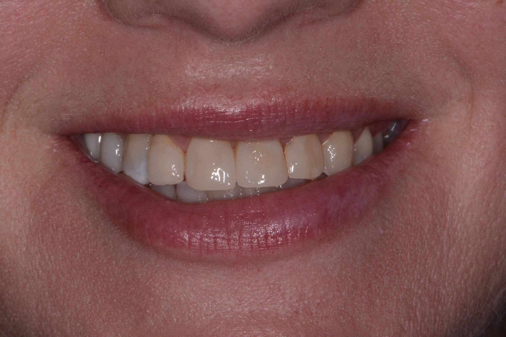 Before Image