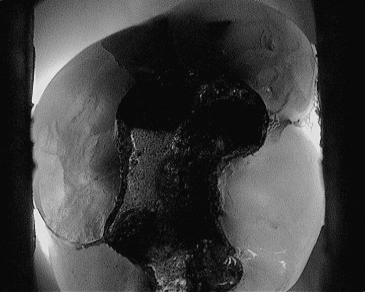 After Image