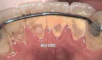 Before Image