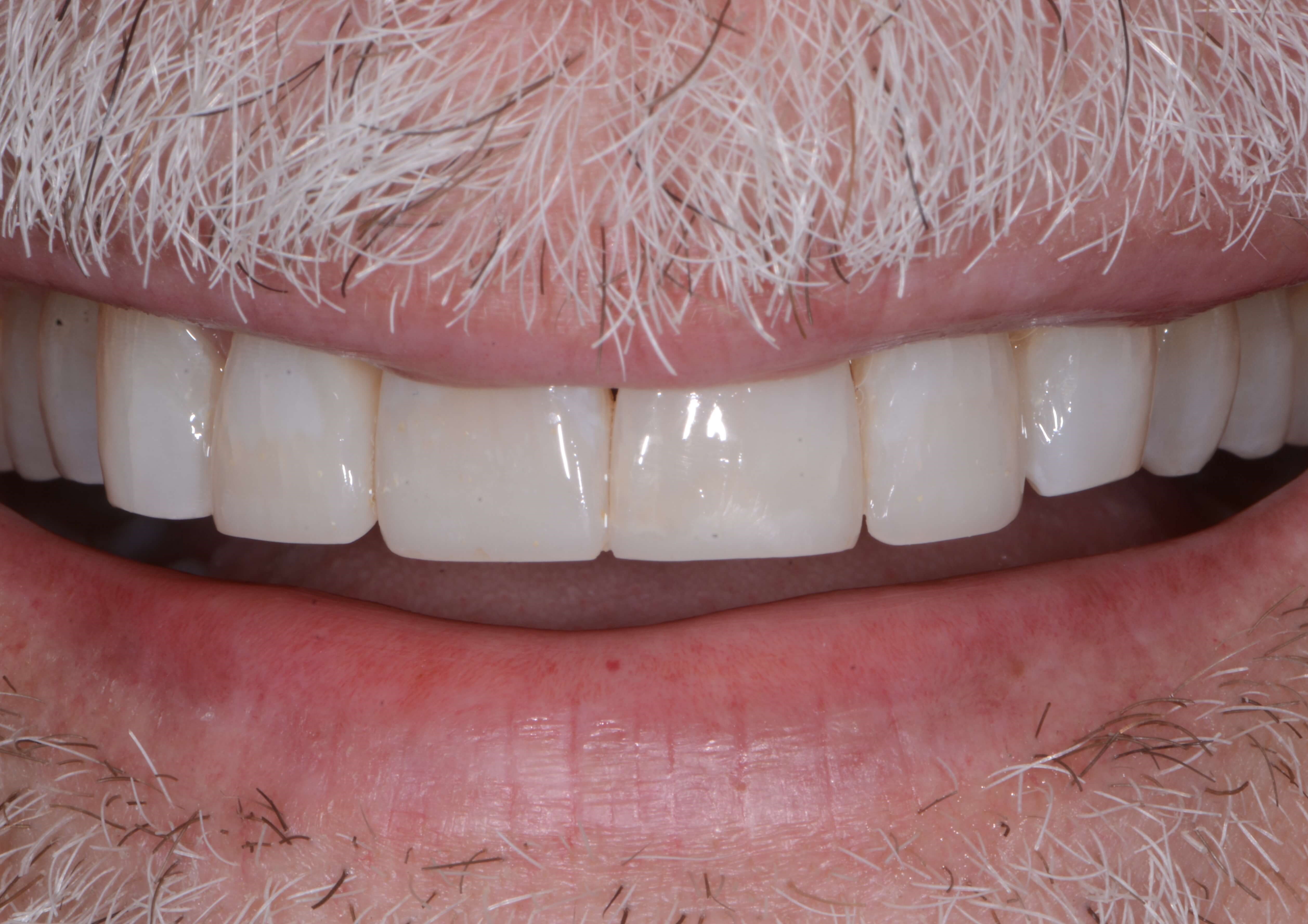 After Image