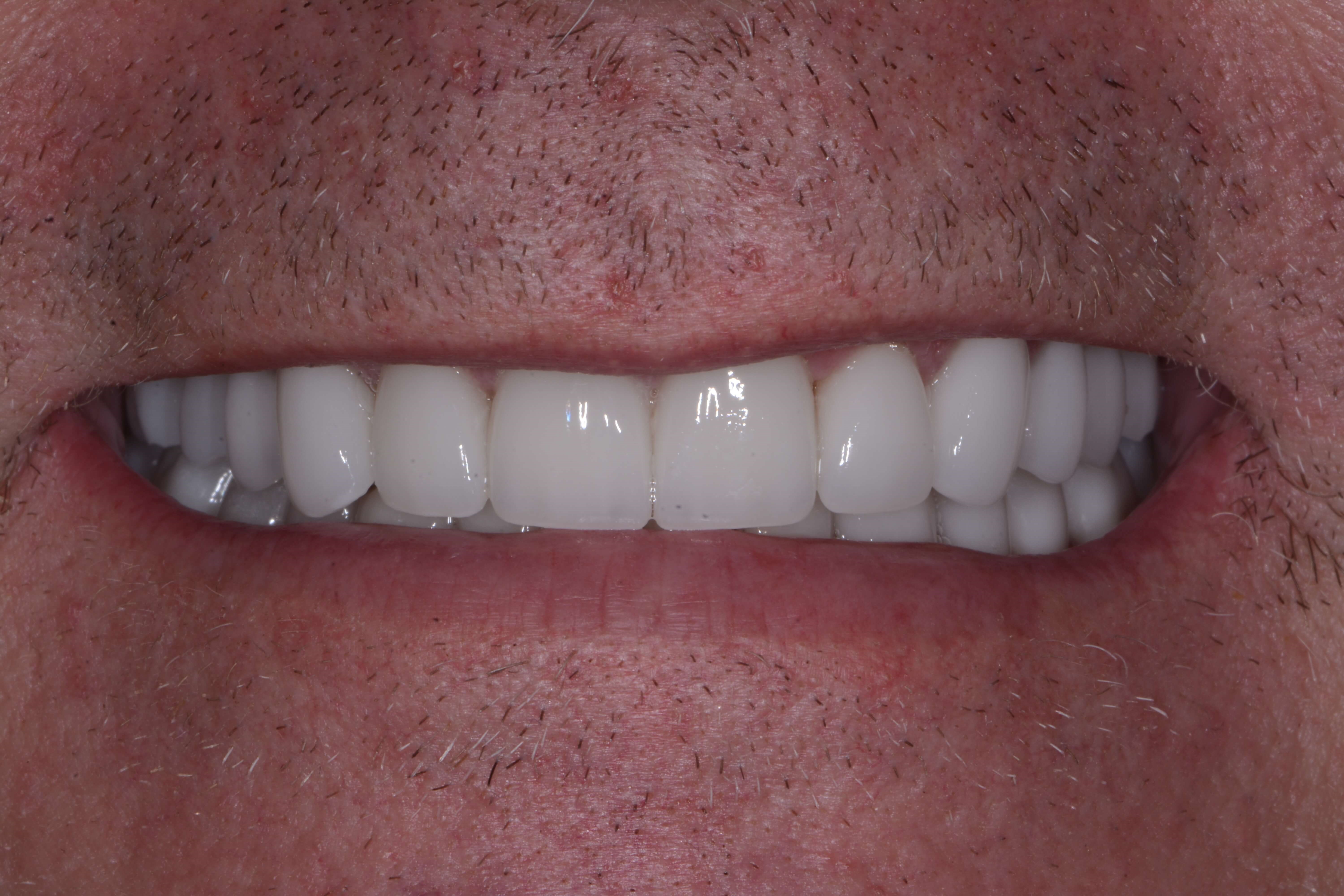 After Image