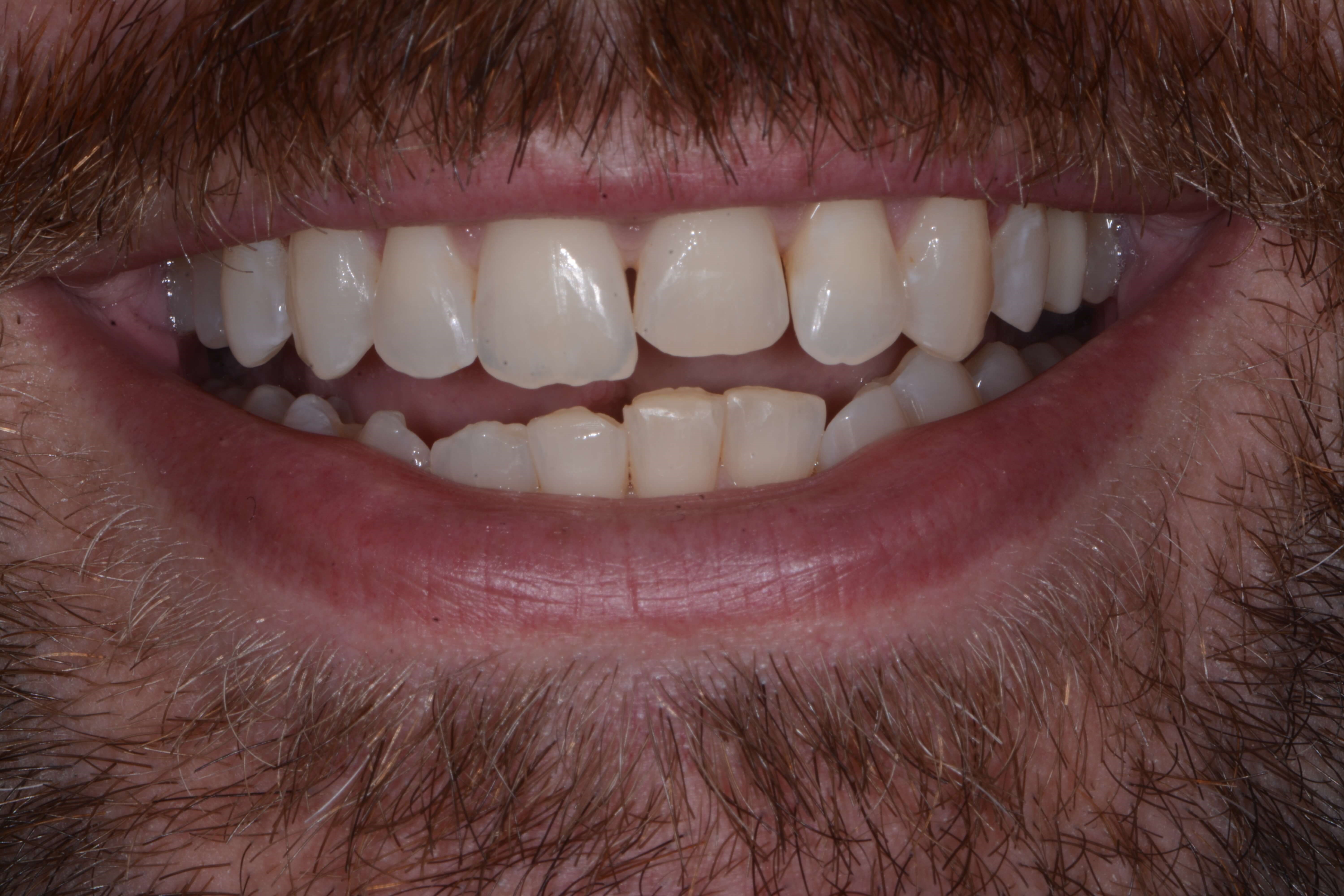 Before Image