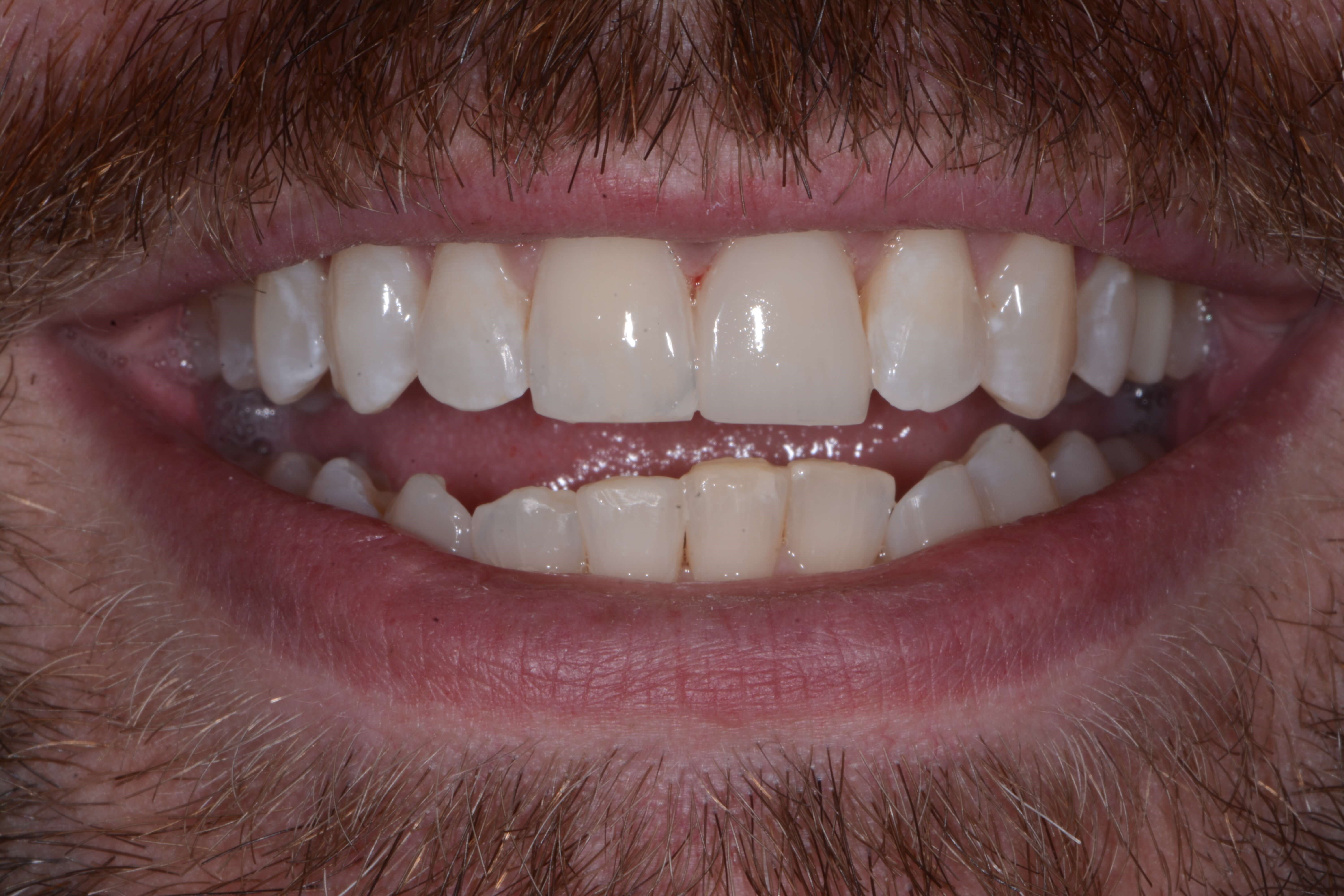 After Image