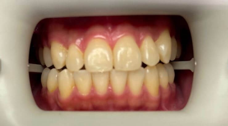 Before Image