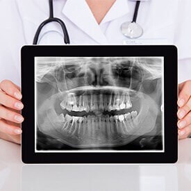 Dental X-rays